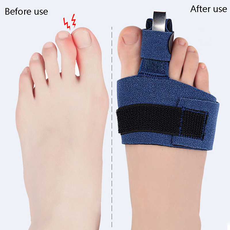 1Pcs Korektor Jari Kaki, Penya - Ankle Brace Sock ulasan dan harga