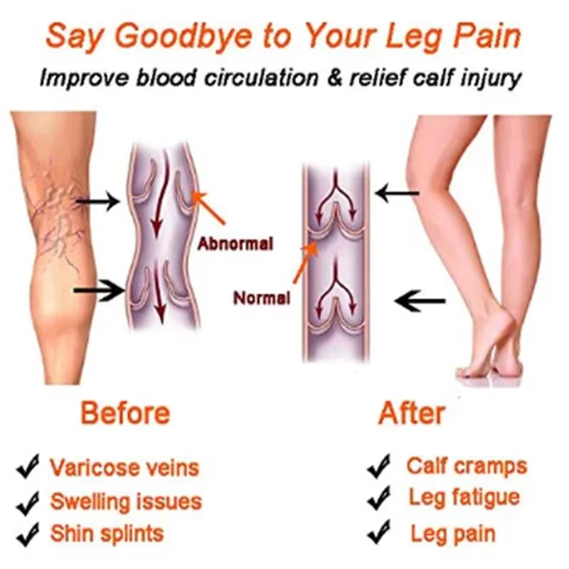 Kaus Kaki Kompresi Wanita, Kau - Compression Sleeve Calf ulasan dan harga